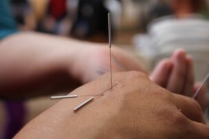 リンゴ病：鍼灸医学的な体質別予防対策